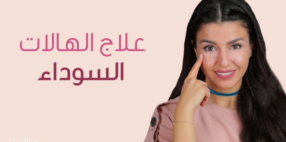 نصائح ومكياج لإخفاء الهالات السوداء