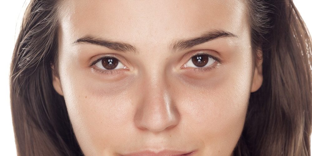 عصير الخيار و البطاطس يخلصانك من الهالات السوداء