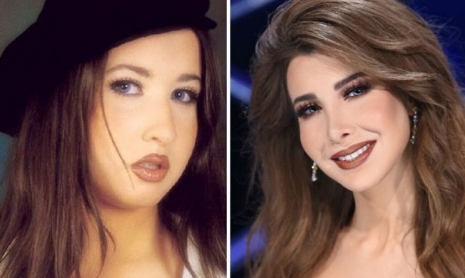 صور صادمة للنجمات قبل خضوعهن لعملية تجميل الأنف (صور)