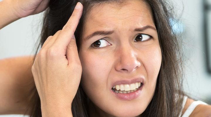 أضيفي هذه المكونات الطبيعية للشامبو و تخلصي من القشرة