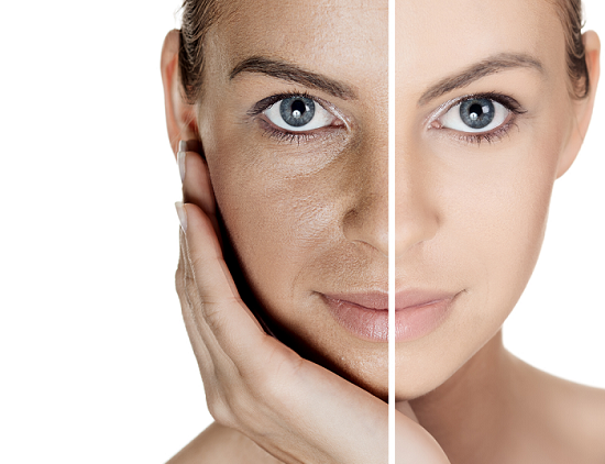 العسل و الكاكاو لإزالة الكلف …وصفة