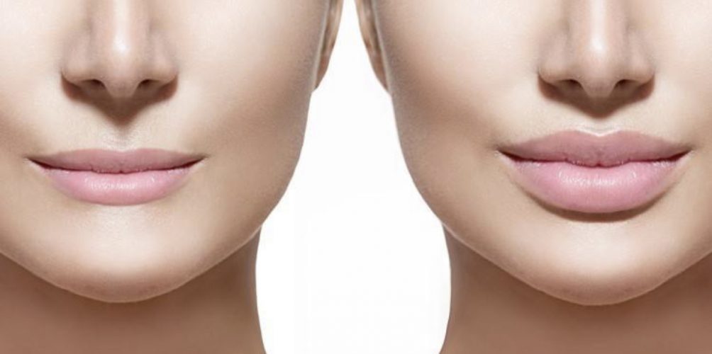 وصفة القرفة والفازلين القرفة لنفخ شفاهك طبيعيا في المنزل !