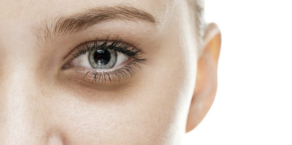 تخلصي من الهالات السوداء بهذا الماسك الطبيعي !