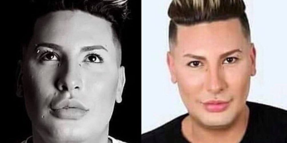 وفاة مغني الراي الجزائري هواري منار أثناء إجرائه عملية تجميلية !