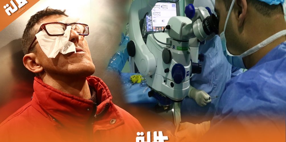 إنسانية طبيب تنقذ شاب فقير من فقدان بصره