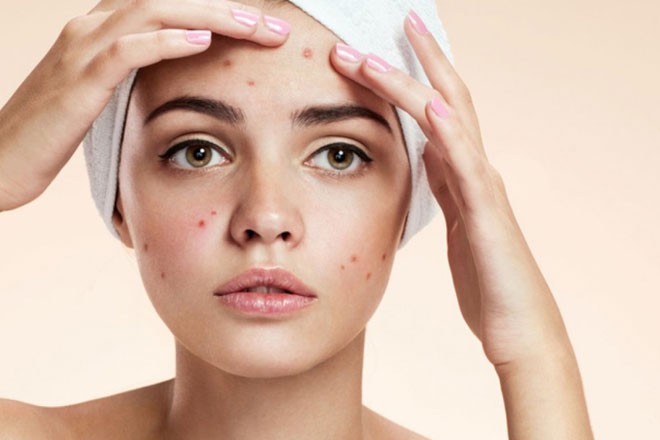 عصير الجزر لإشراقة البشرة و وصفات طبيعية لإزالة حب الشباب و التصبغات