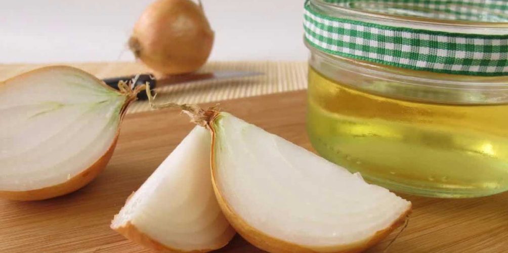 ماسك البصل.. علاج تساقط الشعر وتقوية بصيلاته