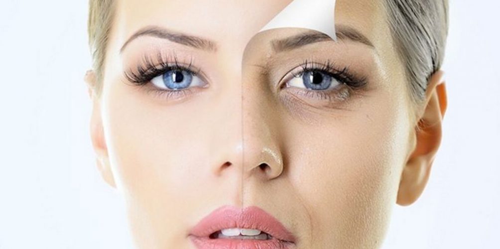 علاج الهالات السوداء.. خطوات بسيطة