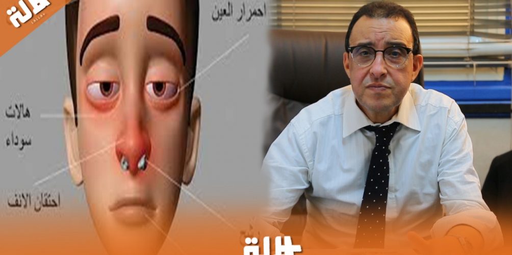 كل ما تودون معرفته عن الحساسية مع الدكتور عبد الله بهاني الاختصاصي في أمراض الحساسية