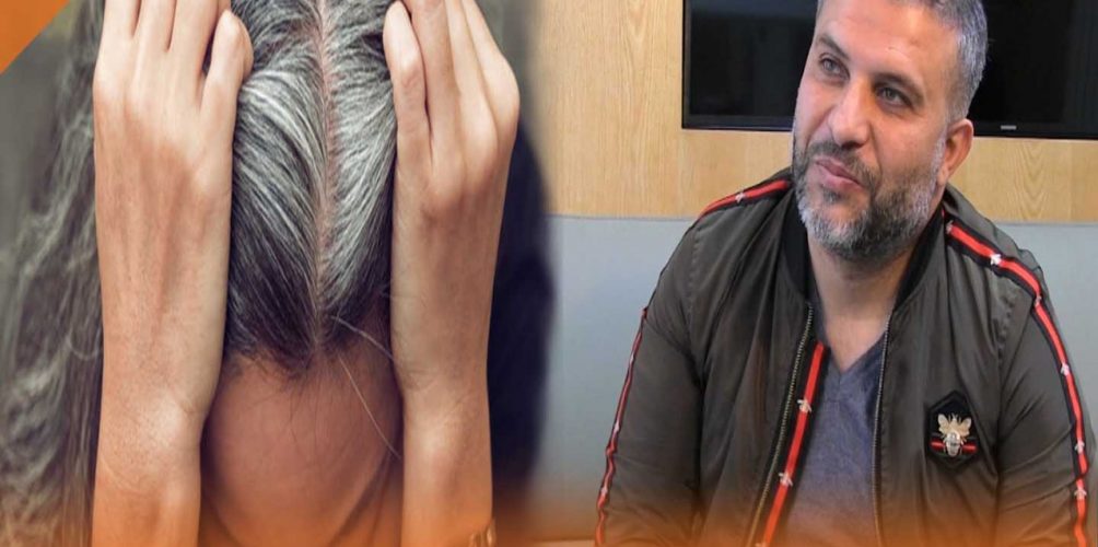 محمد جحا خبير الشعر: الشيب وراثي ولا علاقة له بصبغة الشعر (فيديو)
