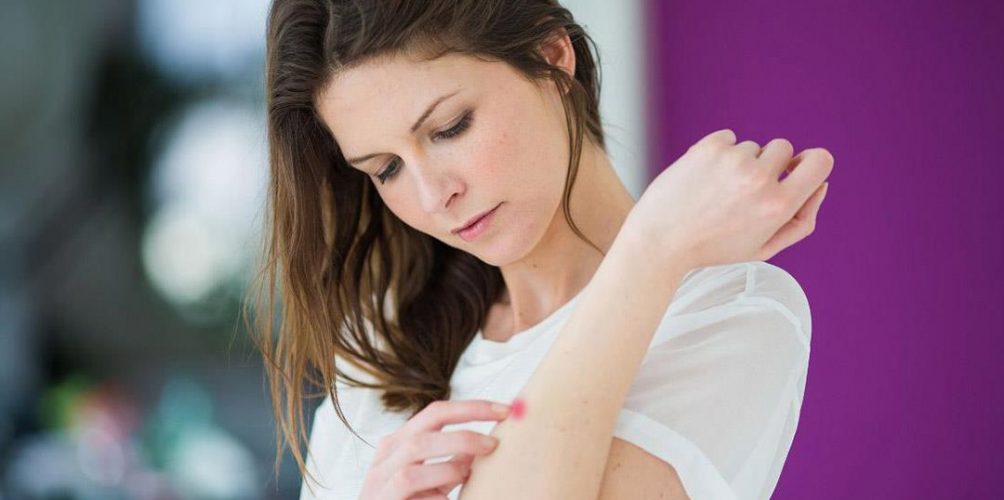 « الذئبة الحمراء » مرض يهدد حياة الشابات في المغرب.. تعرفي على أعراضه 