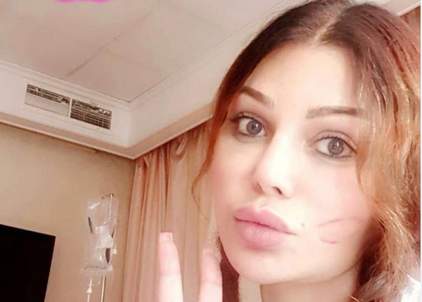 « اشتقت لكم ».. هيفاء وهبي تطمئن جمهورها عن صحتها