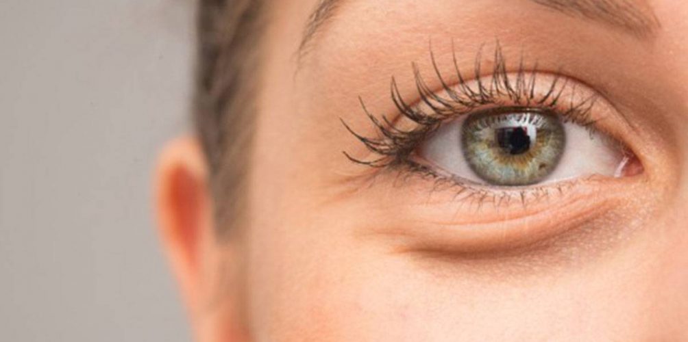 لعلاج مشاكل محيط العين.. قناع الزنجبيل والعسل الأبيض خيارك الأمثل!