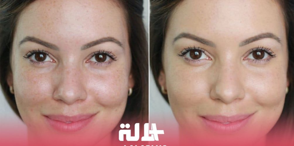 تضمن لك بشرة صافية ونقية ودون عيوب.. كل ما تحتاجين معرفته عن تقنية « بيبي جلو » التجميلية (فيديو)