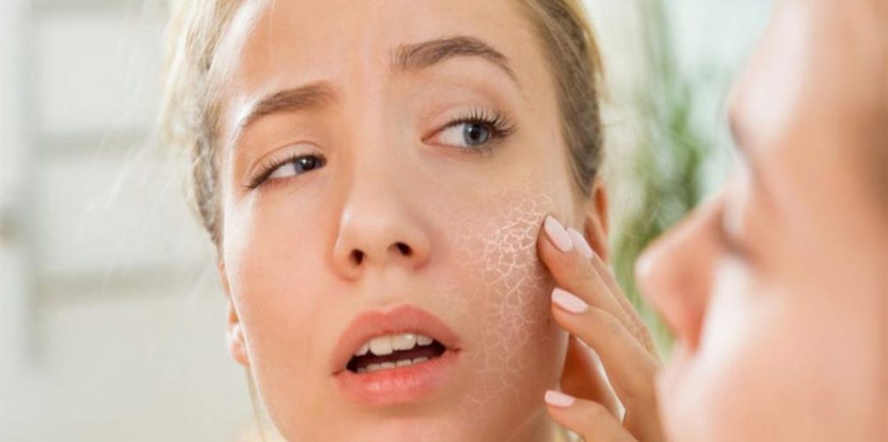 للتخلص من جفاف البشرة في رمضان.. جربي خلطة زيت الزيتون والأفوكادو والعسل