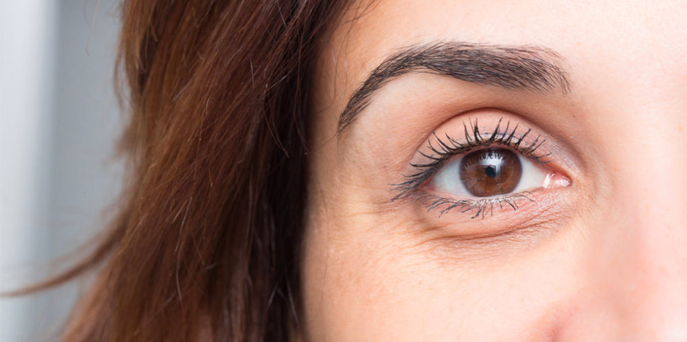 للتخلص من الهالات السوداء.. جربي قناع العسل وزيت اللوز