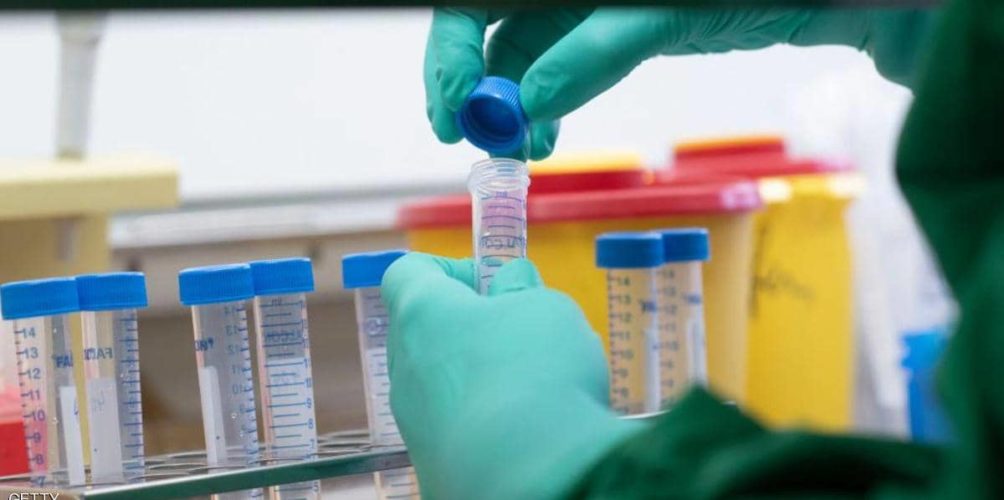 يحد من الوفاة ويباع بأسعار معقولة.. الإعلان عن أول تجربة سريرية ناجحة لعلاج لكورونا