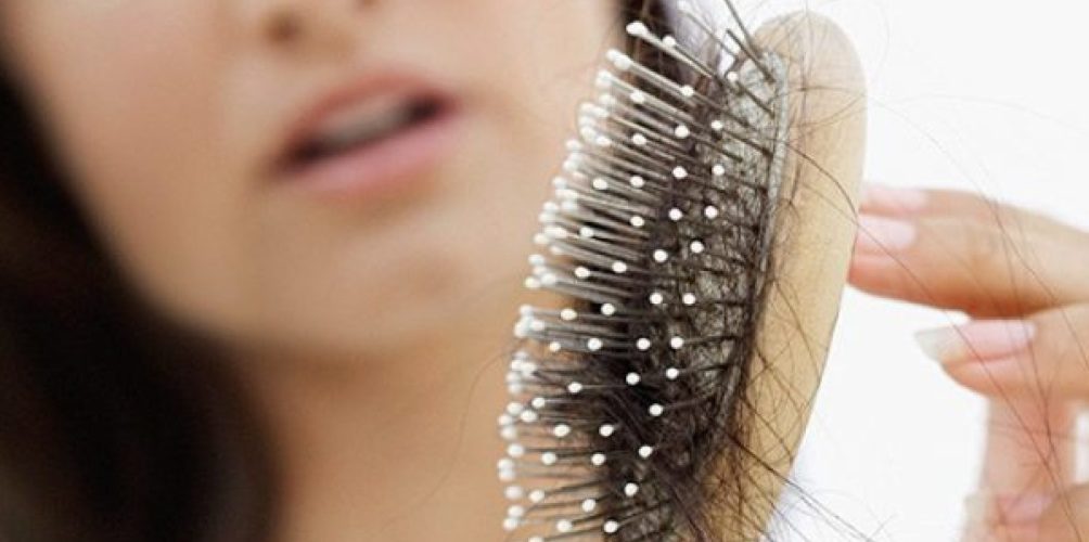 بينها عصير البصل.. علاجات منزلية تمنع شعرك من التساقط