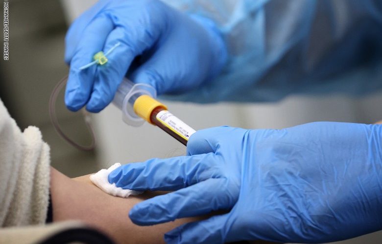 دراسة حديثة: أصحاب هذه الفصيلة من الدم أكثر عرضة للإصابة بكورونا