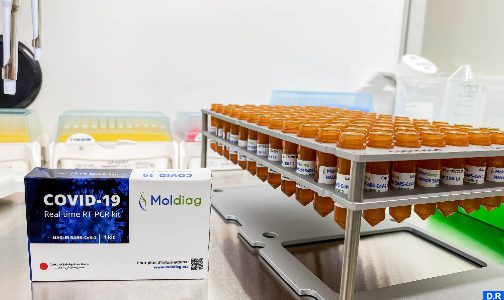 حصل على موافقة وطنية ودولية.. الشروع في إنتاج أول طقم مغربي مائة في المائة لتشخيص كورونا