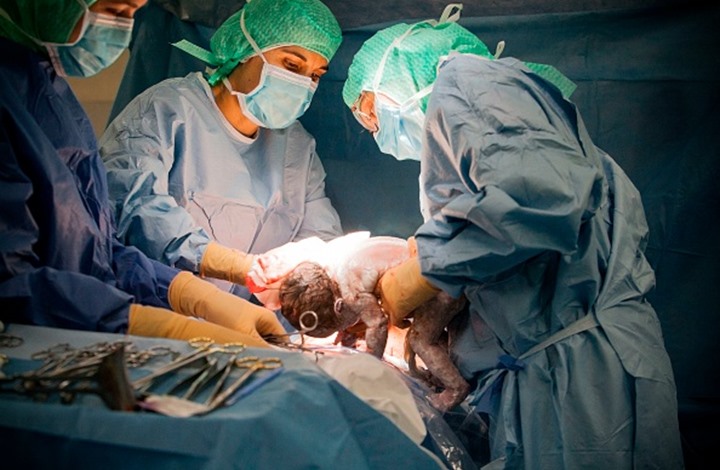 دراسة حديثة: الأطفال المولودون بعملية قيصرية هم الأكثر عرضة للإصابة بالربو