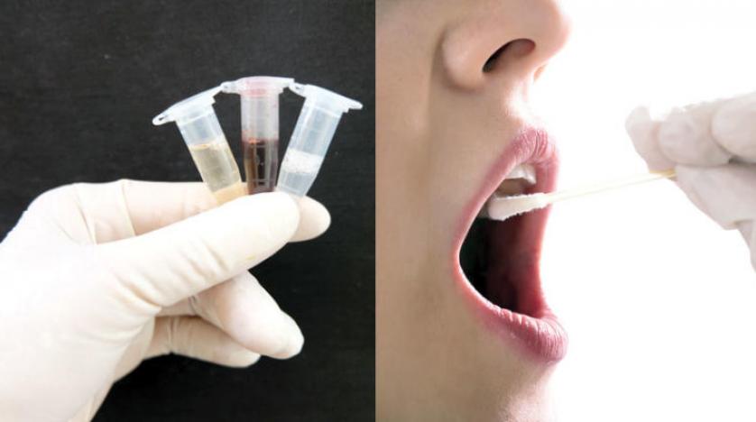 علامة غريبة وغير عادية.. عارض جديد في الفم قد يدل على الإصابة بكورونا