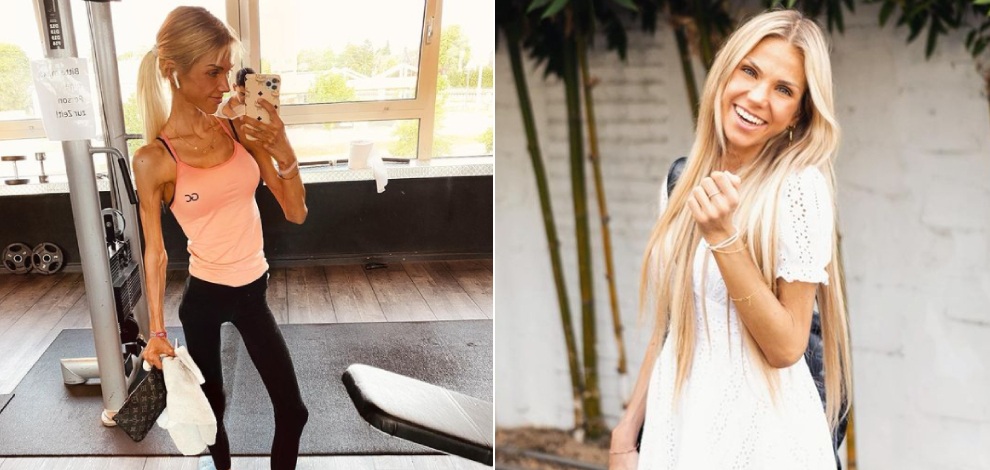 بسبب داء فقدان الشهية.. وفاة مدونة شهيرة في ريعان شبابها