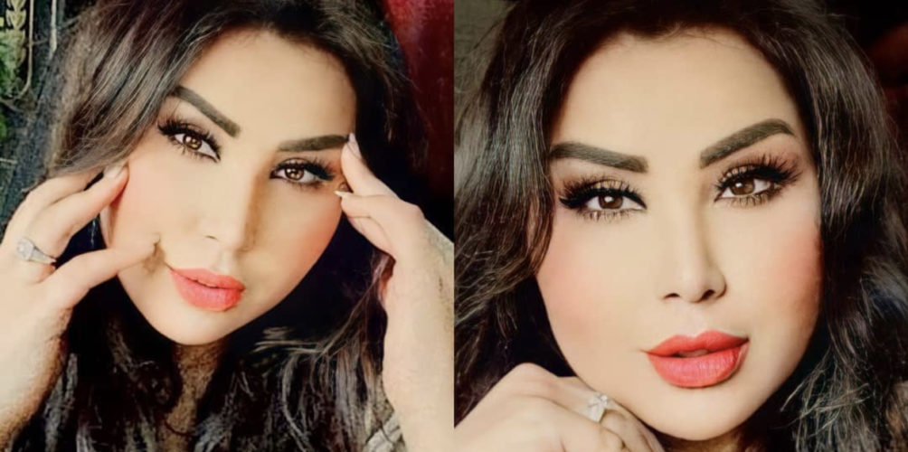 هل خضعت لعملية تجميل؟ سعيدة شرف تفاجئ متابعيها بملامح وجه متغيرة (صورة)