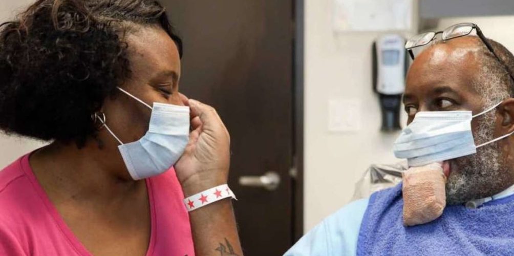 مضاعفات غريبة.. تضخم اللسان عند الإصابة بكورونا