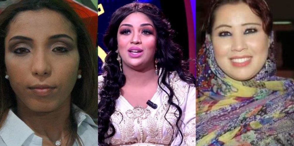 تحول جذري في شكل بعضهن.. فنانات أجرين عمليات تجميل