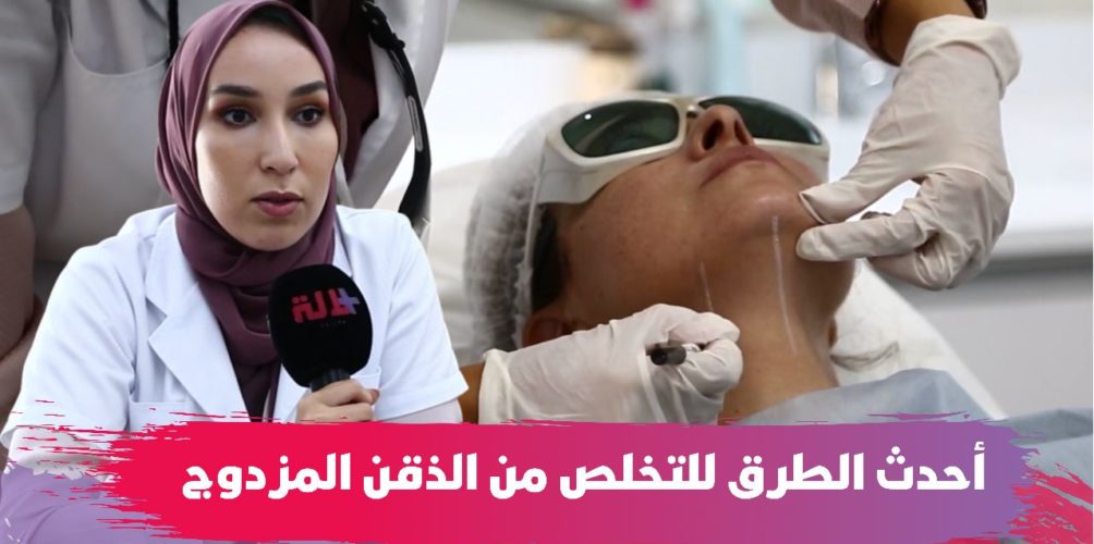 تعاني منه عدة نساء.. أسباب بروز الذقن المزدوج وأحدث الطرق للتخلص منه (فيديو)