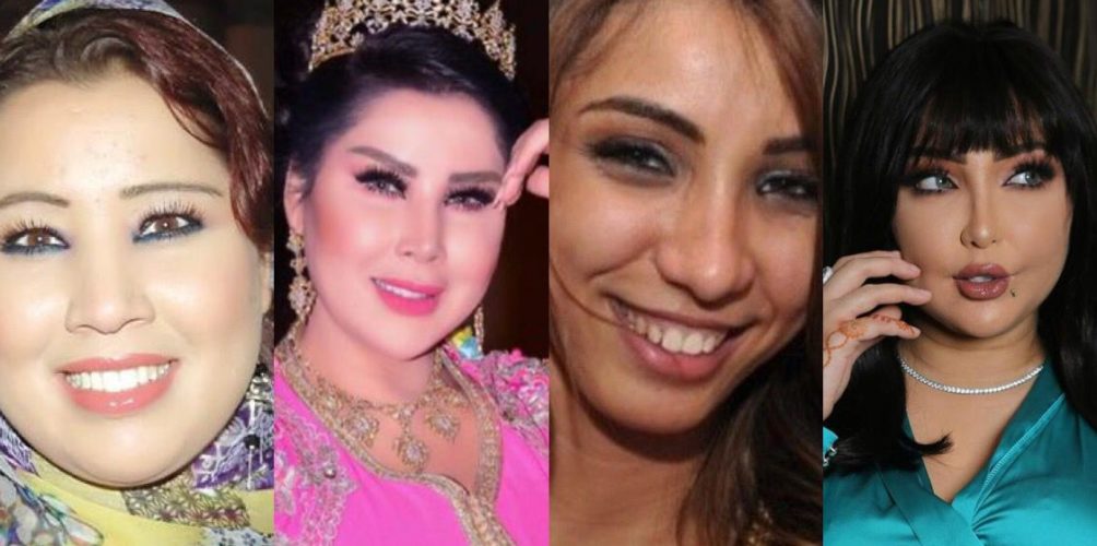 التجميل غير ملامحهما.. سعيدة شرف ودنيا بطمة محط انتقاد رواد مواقع التواصل الاجتماعي