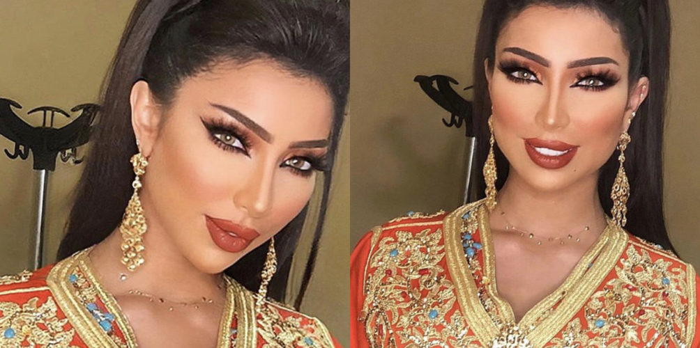 بعد غياب عن الشاشة.. دنيا بطمة تطل على جمهورها في سهرة على القناة الثانية (فيديو)