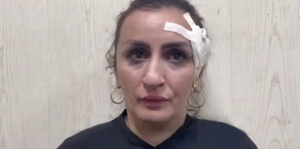 دون رحمة.. أم تبيع مولودها من أجل إجراء عملية تجميل