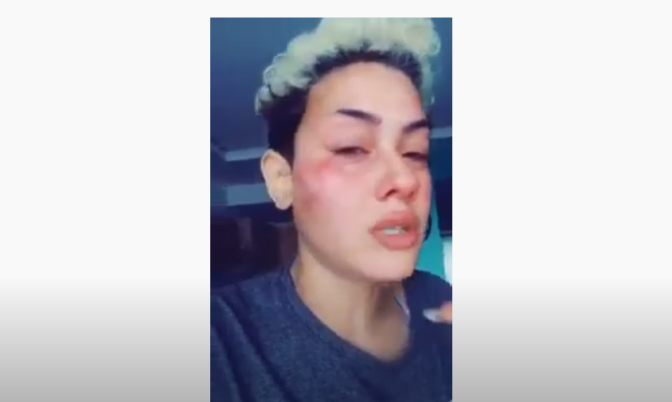 حين يتحول حلم الزواج من رجل تركي إلى كابوس.. قصص مغربيات يعانين في تركيا (فيديو)