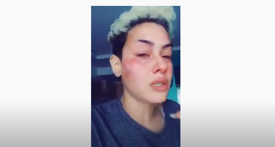 حين يتحول حلم الزواج من رجل تركي إلى كابوس.. قصص مغربيات يعانين في تركيا (فيديو)