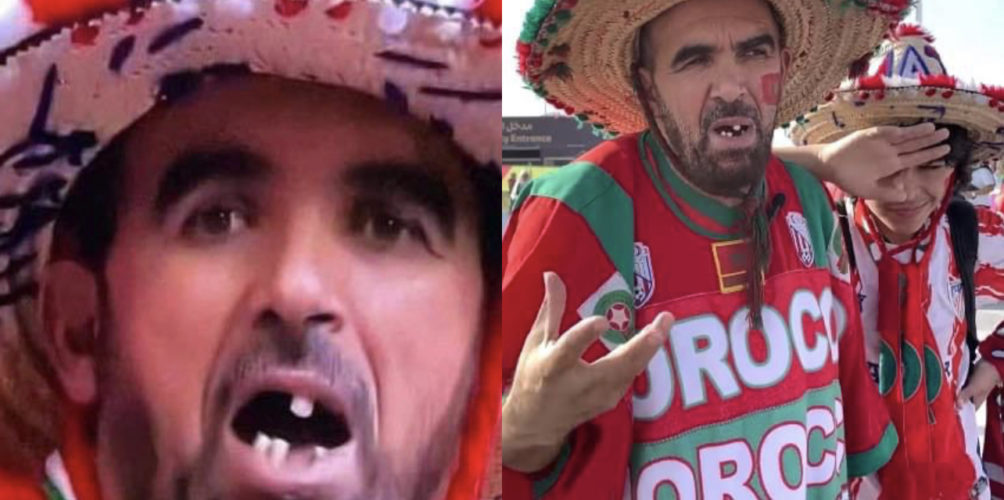 بعد تعرضه للتنمر.. طبيب أردني يتبرع بصنع ابتسامة مشجع مغربي