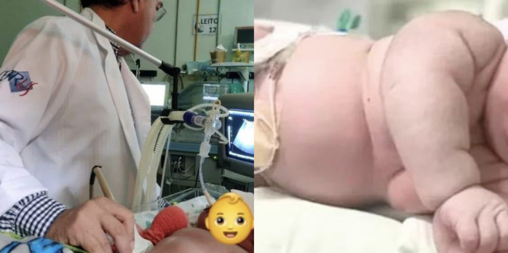 يزن أزيد من 7 كيلوغرامات.. مولود يحطم رقما قياسيا