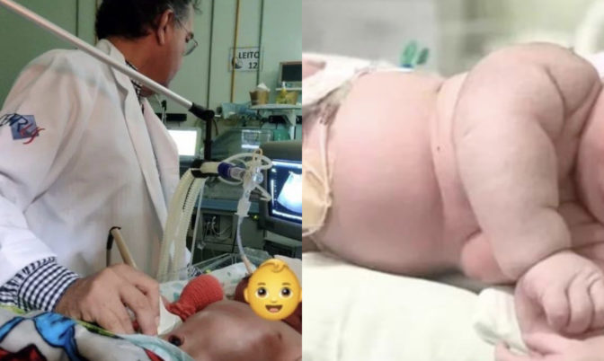 يزن أزيد من 7 كيلوغرامات.. مولود يحطم رقما قياسيا