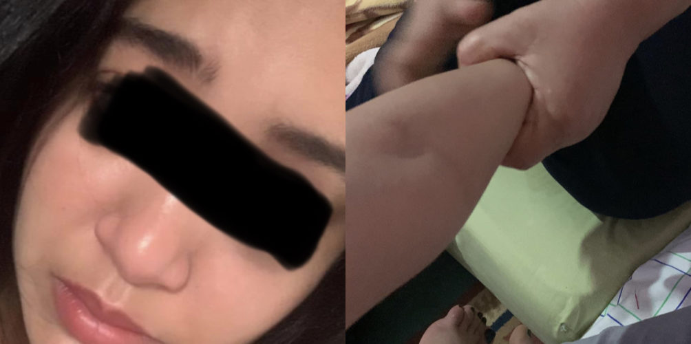 على يد والدها.. مصدر أمني يكشف حقيقة تعرض شابة للتعنيف والاغتصاب في الداخلة (صور)