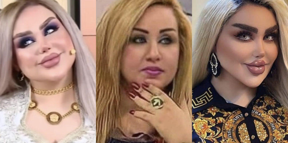 أجرت 43 عملية تجميل.. العراقية داليا نعيم تثير الجدل (صور)
